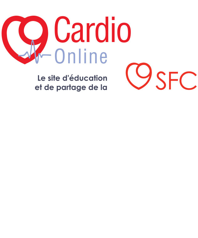 Online cardio sale